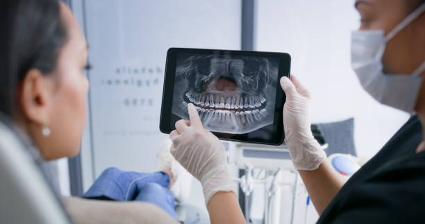 Licensed Teeth Whitening service in Martinsville, IN - Smile Center Dentistry